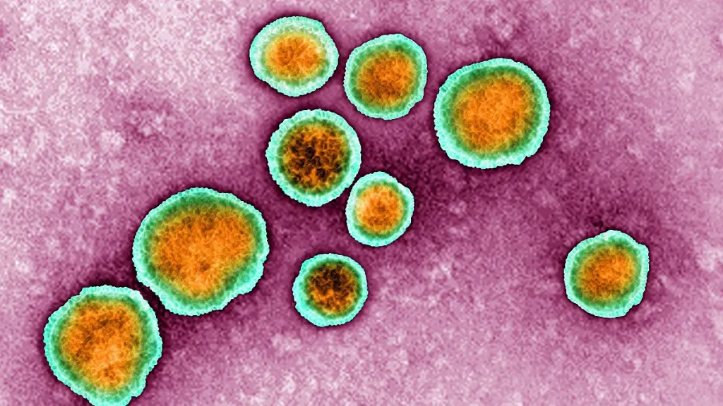 RKI: RSV-Welle rollt an – Gefahr für Kinderkliniken wächst