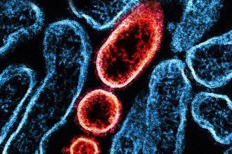 Nipah-Virus: Übertragung, Symptome, Behandlung – gab es Fälle in Deutschland?