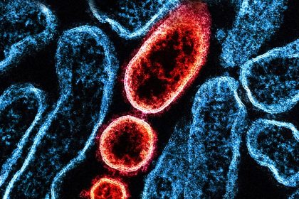 Nipah-Virus: Übertragung, Symptome, Behandlung – gab es Fälle in Deutschland?