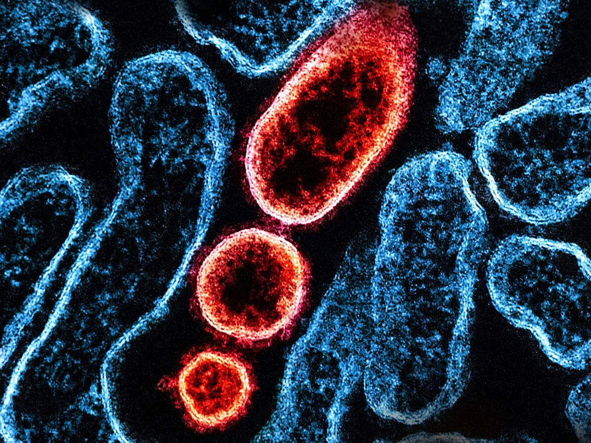 Nipah-Virus: Übertragung, Symptome, Behandlung – gab es Fälle in Deutschland?