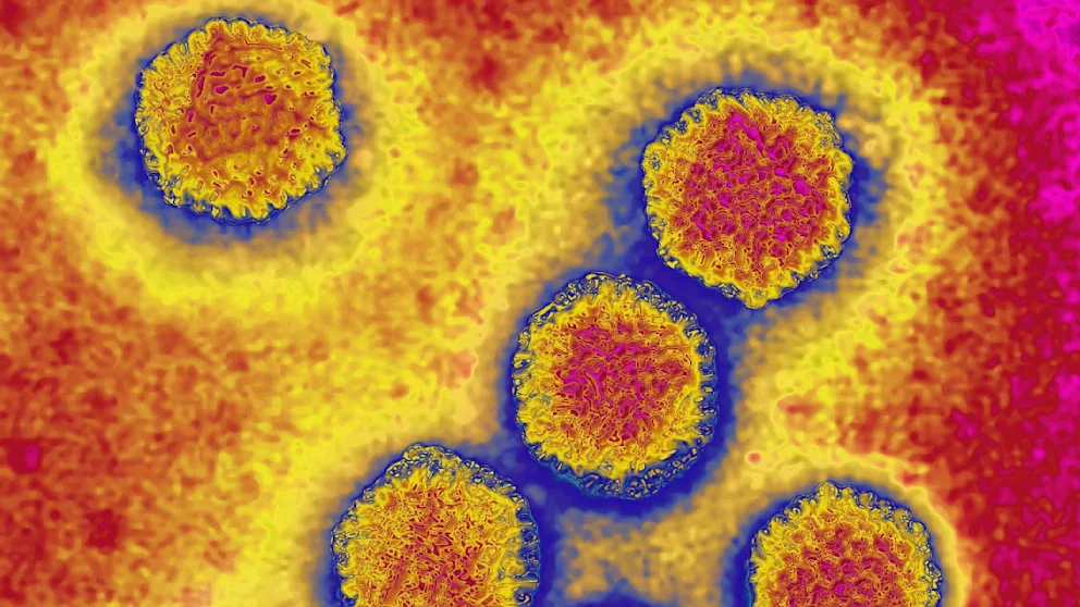 Hepatitis-A-Ausbruch in Neapel: Symptome, Übertragung und Risiko für deutsche Touristen