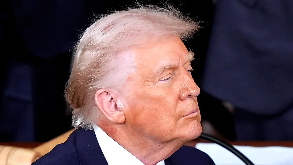 Großer roter Fleck an Trumps Hals sorgt für Aufsehen – ist der US-Präsident krank?