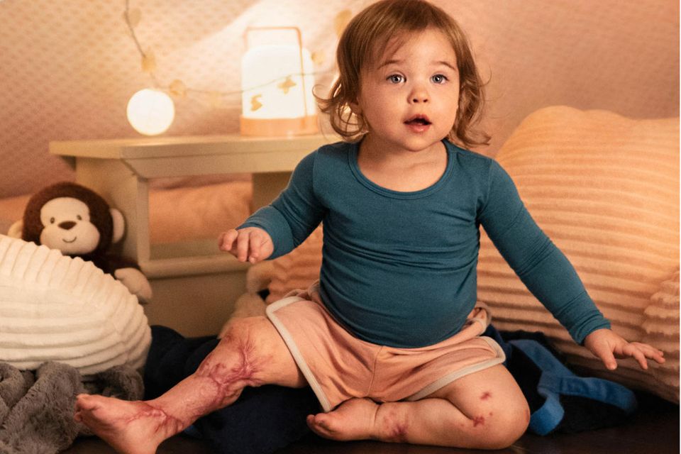 Meningitis Typ B: Symptome, Risiken und Verlauf in Deutschland 2026