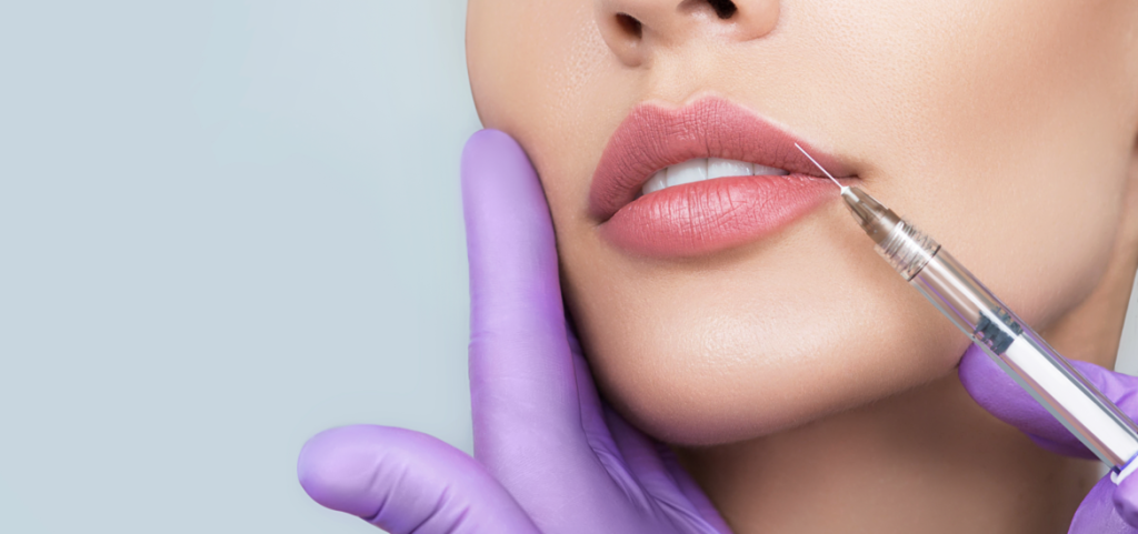 Lippen aufspritzen 2026: Trends, Risiken und natürliche Ergebnisse