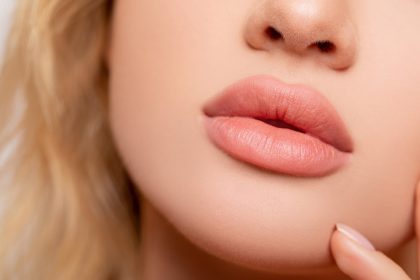 Lippen aufspritzen 2026: Trends, Risiken und natürliche Ergebnisse
