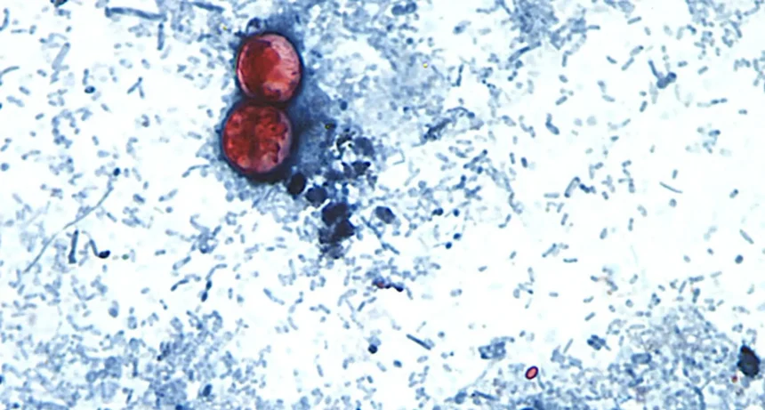 Parasiten-Ausbruch in den USA: Wie groß ist die Gefahr für Deutschland?