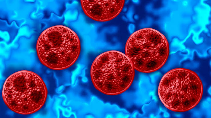 Parasiten-Ausbruch in den USA: Wie groß ist die Gefahr für Deutschland?