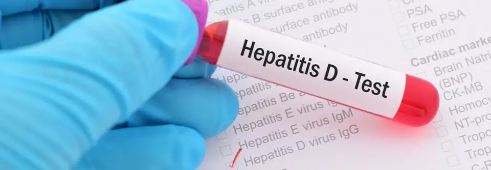 Hepatitis D: Symptome, Übertragung, Behandlung und Schutz vor der gefährlichen Leberinfektion
