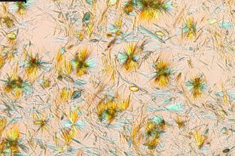 Sildenafilcitrat-Kristalle unter polarisiertem Licht im Mikroskop