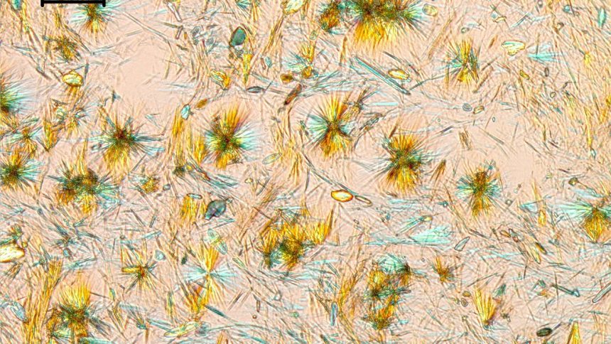 Sildenafilcitrat-Kristalle unter polarisiertem Licht im Mikroskop